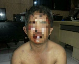 Babak Belur, Pelaku Curanmor Dihajar Massa di Lau Dendang