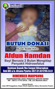 Bocah Penderita Hidrosefalus Ini Butuh Uluran Tangan Dermawan