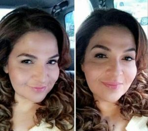 Klinik Kecantikan dr. Geeta, Terbaik,  Berpengalaman Dan Profesional
