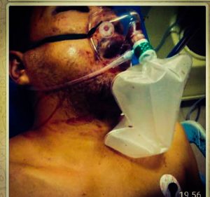 Misteri Kematian Golfried, SIKAP: Keterangan Polisi Banyak Kerancuan