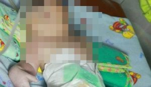Banyak Bayi Lahir Dengan Kelainan, Bupati Madina Keluarkan Larangan Penambangan Emas Ilegal
