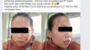 Gara-Gara Tanya Bansos Covid-19, Wanita Ini Dianiaya Ibu RT