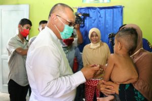 Plt Wali Kota Medan Salurkan Bantuan Untuk Bocah Penderita Kelainan Fisik