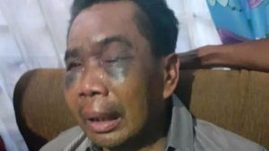 Dugaan Penyiksaan Terhadap Sarpan Oleh Oknum Polisi, LBH Medan : Tindakan Tak Manusiawi