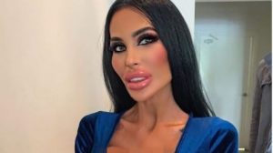 Ingin Mirip Boneka, Perawat Ini Ketagihan Operasi Plastik