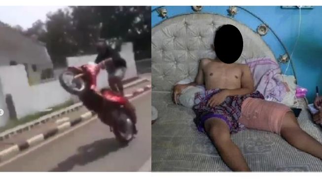Niat Pamer Freestyle, Pemuda ini Malah Terjatuh Dan Alami Patah Kaki