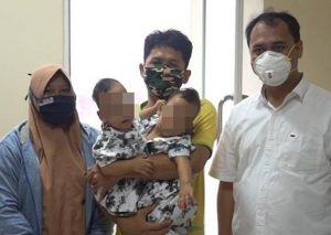 RSUP H Adam Malik Lakukan Operasi Lanjutan Bayi Kembar Siam Adam dan Aris
