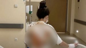 Emosi Karena Dibangunkan Untuk Sarapan, Pria Ini Siram Istrinya Dengan Air Mendidih