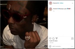 Heboh, Rapper Amerika Ini Tindik Berlian Seharga Rp 337 Miliar di Dahinya