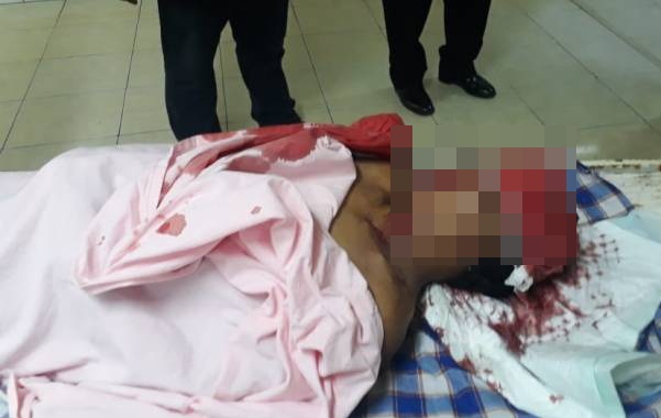Tabrak Tiang Listrik , Pengendara Motor Ini Meninggal Dunia