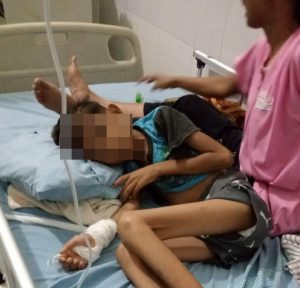 Atensi Bobby Nasution, Aldi Bocah Penderita Paru Kini Dirawat di RS Pirngadi