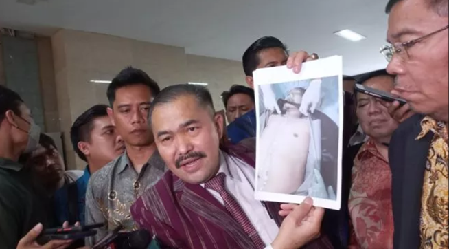 Diberi Surat Kuasa Keluarga Brigadir J, Kamaruddin Gugat Istri Sambo Soal Laporan Palsu Pelecehan Seksual