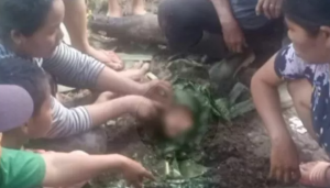 Disambar Petir, Nyawa Bocah di Langkat Ini Tertolong Usai Ditanam dalam Tanah Pakai Daun Pisang 