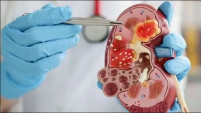 Dapat Pasokan, RSUP Haji Adam Malik : Stok Obat Penanganan Gangguan Ginjal Akut Mencukupi  