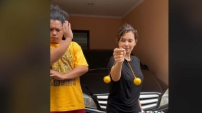 Makan Korban, Bola Mata Bocah SD Ini  Terluka Akibat Bermain Latto-Latto