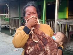 Butuh Biaya Operasi, Balita di Batubara Butuh Uluran Tangan Dermawan